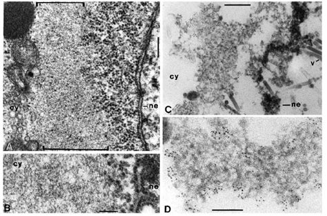 Electron Micrographs Of Ultrathin Sections Through Sf9 Cells Showing