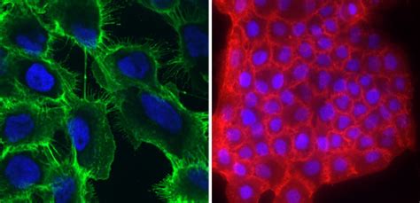 Immunofluorescence (IF/ICC) Antibody-Cell Membrane | Sino Biological