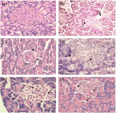 Histopathology Of Pancreas At The End Research With Hematoxylin And