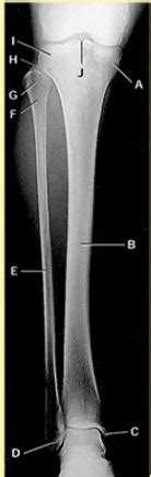 Radt Tibia Fibula Patella Femur Labeling Quiz Flashcards Quizlet