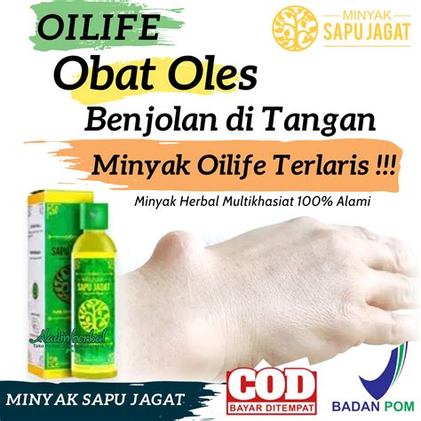 OLIFE Oil Obat Oles Benjolan Di Tangan Obat Kista Ganglion Obat