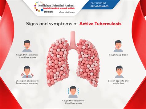 Signs and symptoms of active tuberculosis - World Tuberculosis Day