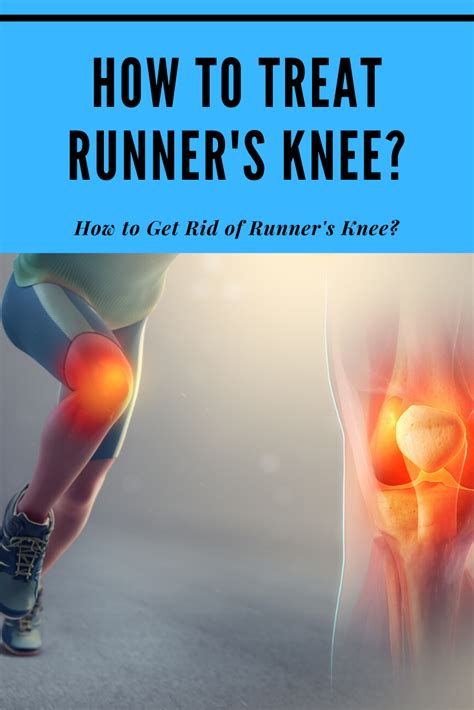 How To Get Rid Of Runner S Knee How To Treat Runner S Knee