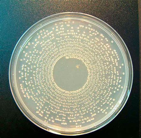 Marine Agar Scheda Del Terreno Di Coltura Per Microbiologia