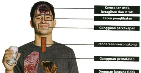 Kesan Penyalahgunaan Dadah Terhadap Negara Hal Ini Demikian Kerana