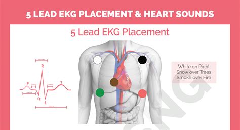 Lead Ekg Placement