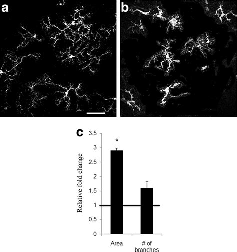 Bmp7 Alters Microglial Morphology Retinal Flatmounts From 1 Day