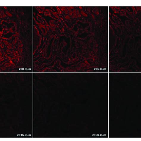 Clsm Confocal Laser Scanning Microscopy Photomicrographs Of Nasal