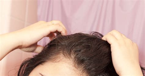 The Best Treatment For Thinning Hair Fashionnfreak