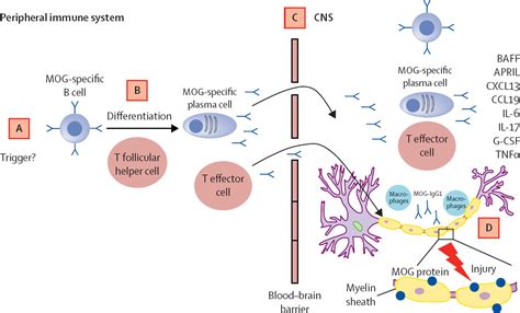 Myelin Oligodendrocyte Glycoprotein Antibody Associated Disease The Lancet Neurology