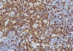 IHC Reagents | Immunohistochemistry Reagents | Sakura Finetek USA