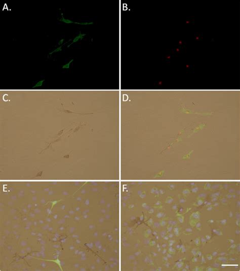 The Macrophage Colony Stimulating Factor M Csf Receptor Csf 1r Is Download Scientific