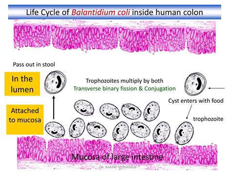 Balantidium Coli Life Cycle Cdc