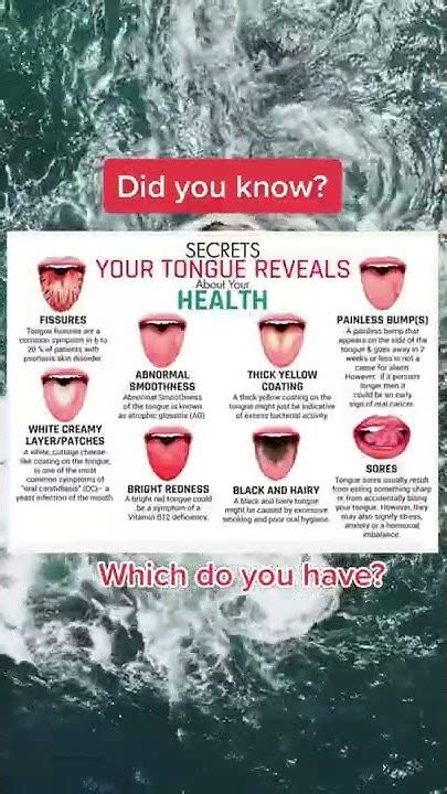 The Secrets Your Tongue Reveals About Your Health Youtube