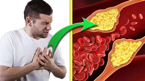 The Ultimate Guide To Lowering Cholesterol Foods Diet And Home