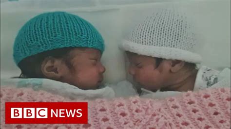 Woman in Covid coma gives birth to twins - BBC News - YouTube