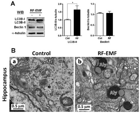 LC3B-II and beclin1 expression and ultrastructure of autophagy in the ...