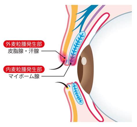 【医師監修】ものもらいは何が原因で起こる？自然治癒できるかや予防法を紹介 セゾンのくらし大研究