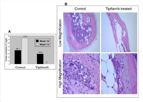 Tipifarnib Is Cytotoxic To Rpmi Cells In An In Vivo Murine Model