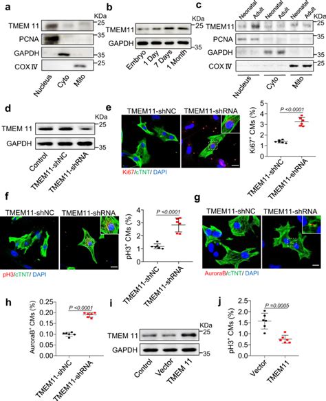 Tmem11 Regulates Cardiomyocyte Proliferation And Cardiac Repair Via