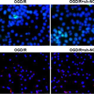 PTEN Knockdown Suppressed OGD R Induced Autophagy In PC12 Cells PTEN