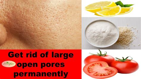 How To Get Rid Of Large Open Pores Permanently Natural Home Remedy