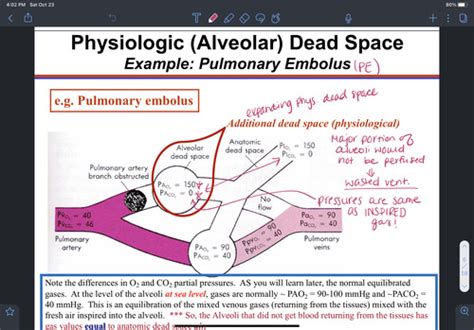 Dsa Alveolar Ventilation Flashcards Quizlet