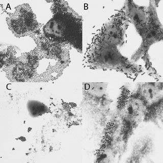 Adherence Patterns Of The E Coli Strains Examined A Aggregative