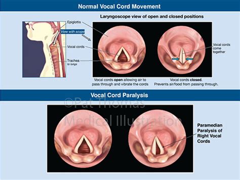 Ear Nose And Throat Pat Thomas Cmi Fami Board Certified Medical