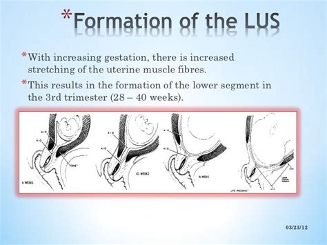 Lower Uterine Segment