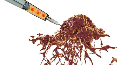 Oncolytic Viral Therapy Photograph By Kateryna Konscience Photo