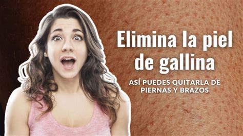 Qué hacer para eliminar la piel de gallina Así puedes quitarla de