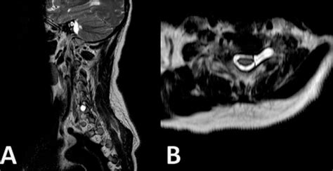 Scielo Brasil Magnetic Resonance As A Method For Diagnosis For