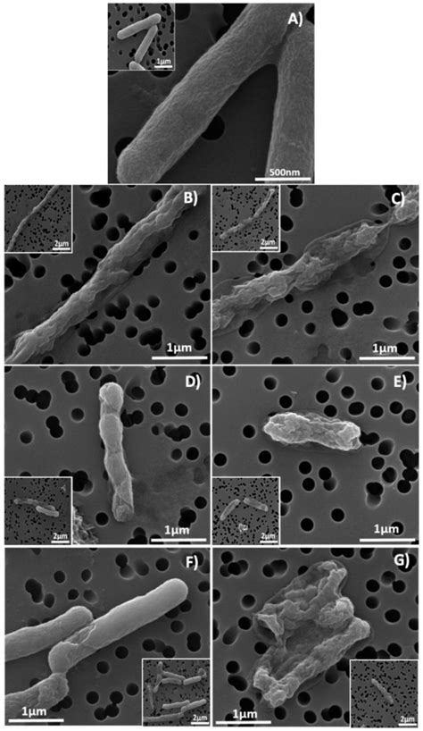 Sem Images Of E Coli A Untreated Control Sample Treated Bacteria