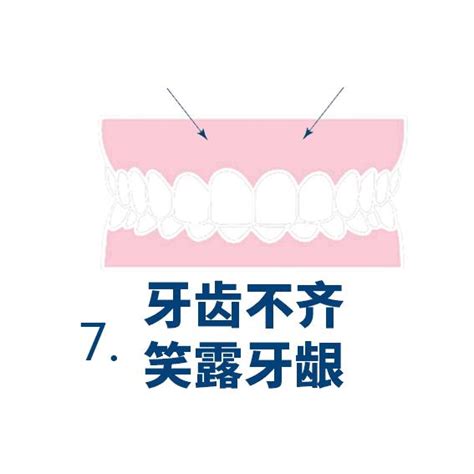 牙齿错颌畸形有多少种类型？你想了解都在这里 知乎