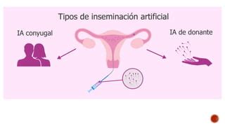 Formas de procreación asistida PPT