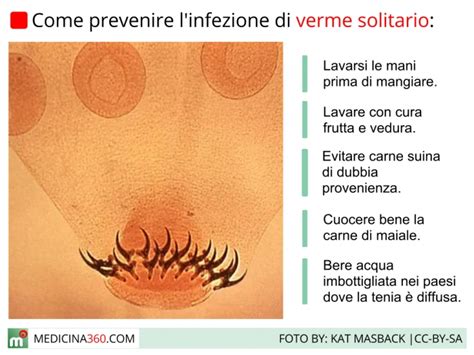 Verme Solitario Sintomi E Cure Della Tenia Intestinale Nell Uomo