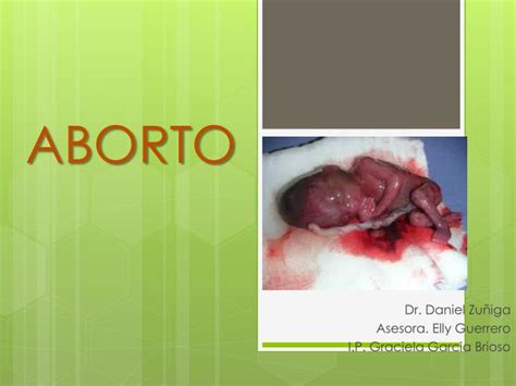 Ppt Aborto Powerpoint Presentation Free Download Id6509224