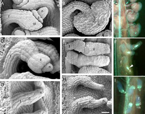 Ovule Phenotypes Of Wild Type Ino And Ant A Comparison Of Wild Type