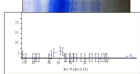 Electropherogram Of Sds Page Gel Of The Most Common Pattern Of Plasma