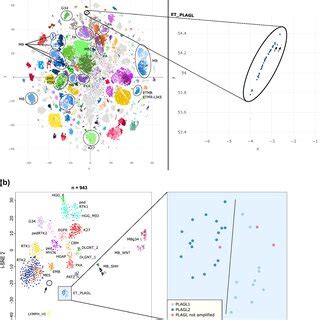 Copy Number Analysis Of Cns Embryonal Tumors With Plagl Gene