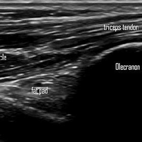 Elbow Ultrasound Anatomy