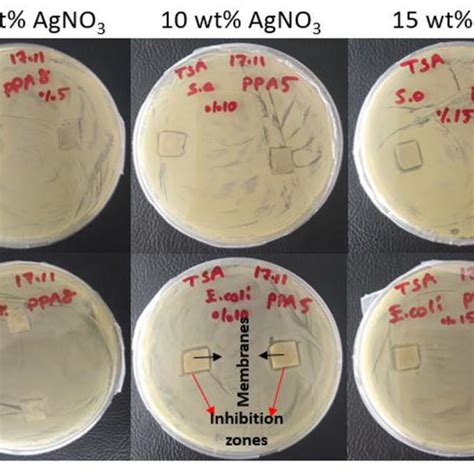 Zones Of Inhibition Around The Two Pan Pvdf Nanofibrous Membranes