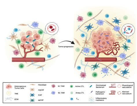 Pancreatic Cancer Is Characterized By A High Tumor And Stroma