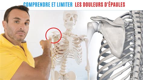 COMPRENDRE LIMITER ET SOIGNER LES DOULEURS D EPAULES YouTube