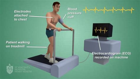 Understanding Heart Scans Stress Tests And Heart Disease Risk