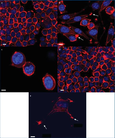 Figure From Reorganization Of Actin Cytoskeleton In L Cells