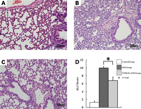 Tnfr Fc Attenuates Lung Destruction Induced By Lps Injection