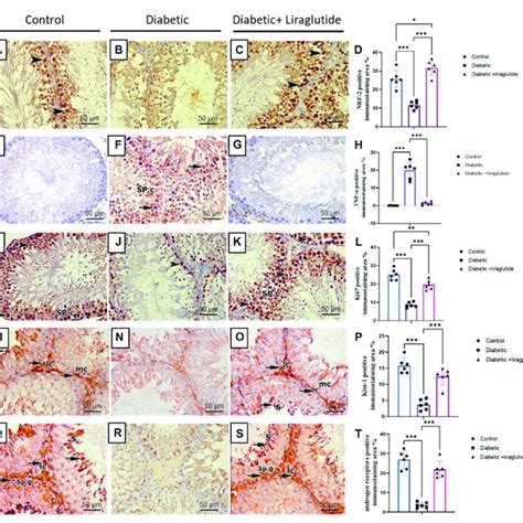 Immunohistochemical Staining Of Testicular Tissues Of Control Stz