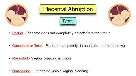 Placental Abruption Symptoms Causes Treatment Types Ultrasound